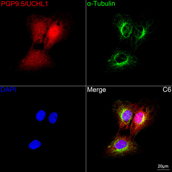 PGP9.5/UCHL1 Rabbit Monoclonal Antibody - Image 5