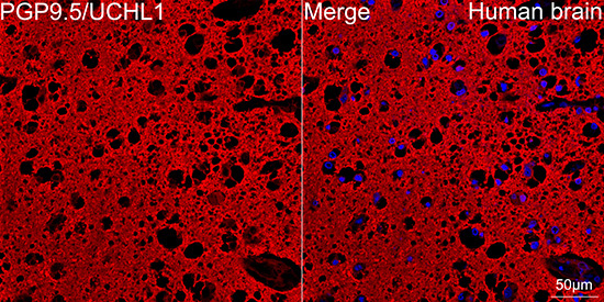 PGP9.5/UCHL1 Rabbit Monoclonal Antibody - Image 6