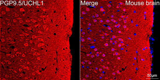 PGP9.5/UCHL1 Rabbit Monoclonal Antibody - Image 7