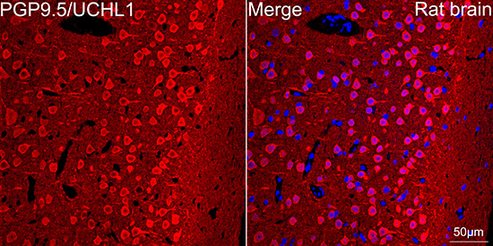 PGP9.5/UCHL1 Rabbit Monoclonal Antibody - Image 8