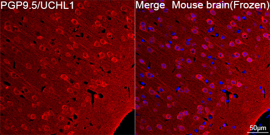 PGP9.5/UCHL1 Rabbit Monoclonal Antibody - Image 9