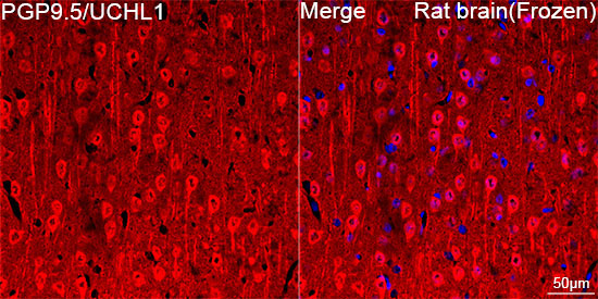 PGP9.5/UCHL1 Rabbit Monoclonal Antibody - Image 10