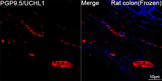 PGP9.5/UCHL1 Rabbit Monoclonal Antibody - Image 11