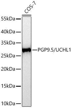 PGP9.5/UCHL1 Rabbit Monoclonal Antibody - Image 12