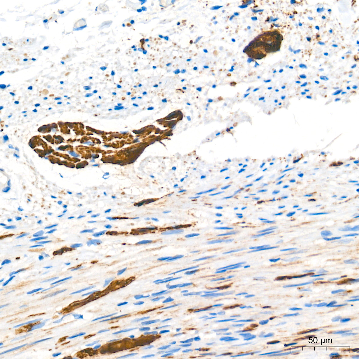 PGP9.5/UCHL1 Rabbit Monoclonal Antibody - Image 15