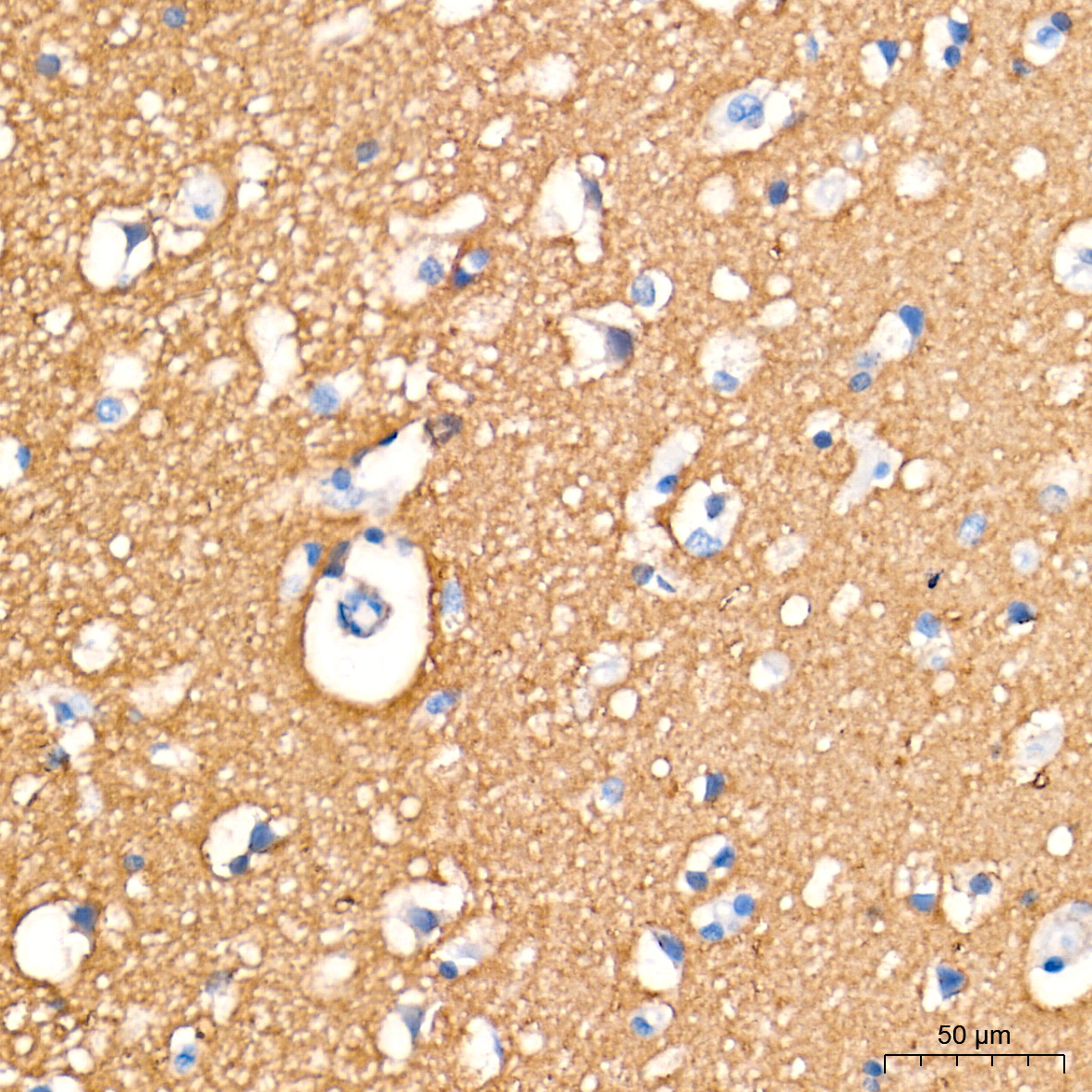 PGP9.5/UCHL1 Rabbit Monoclonal Antibody - Image 16