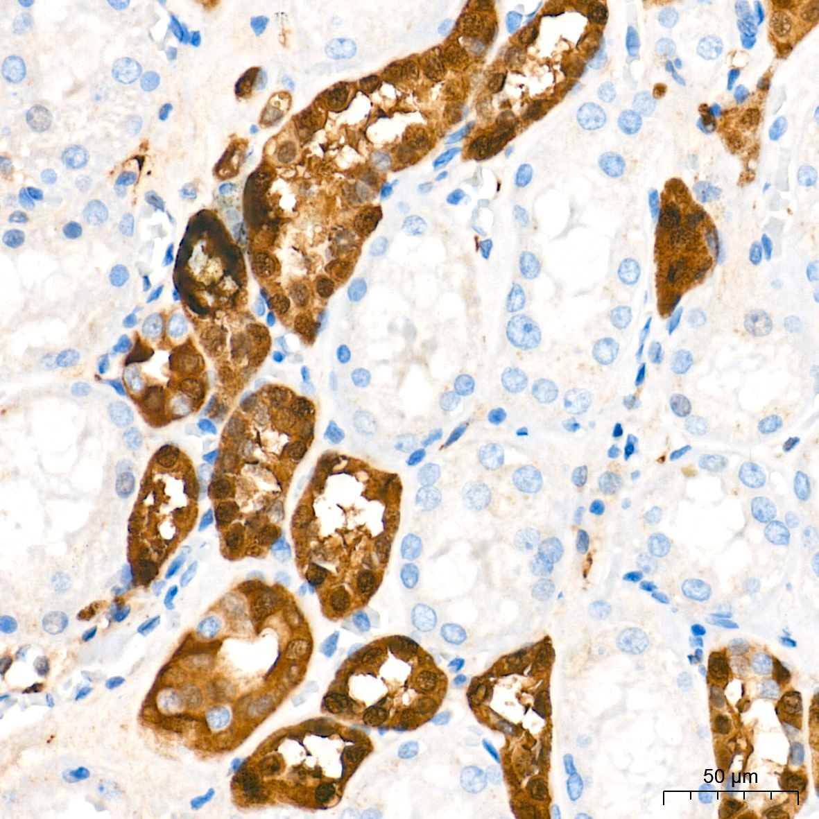PGP9.5/UCHL1 Rabbit Monoclonal Antibody - Image 17