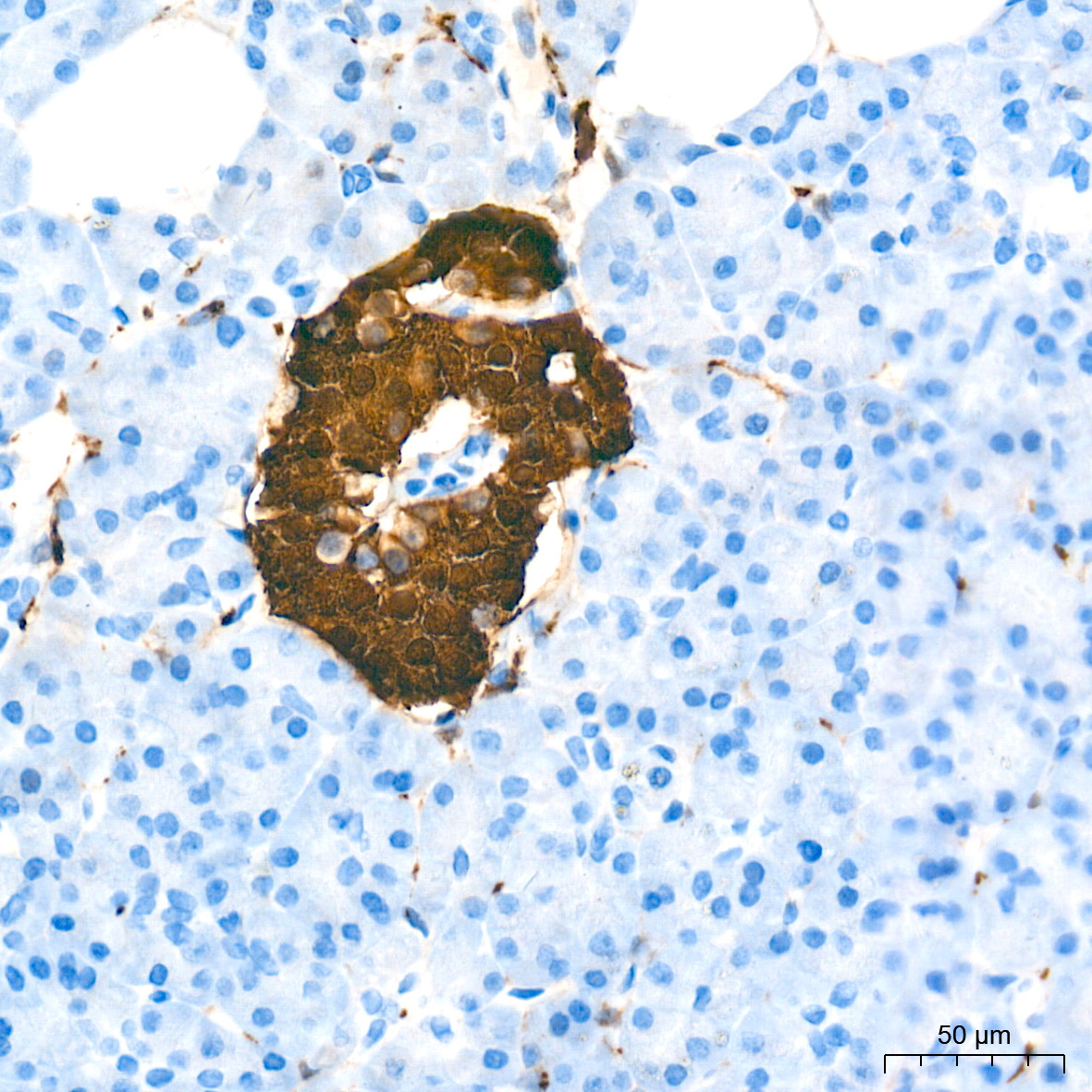 PGP9.5/UCHL1 Rabbit Monoclonal Antibody - Image 18