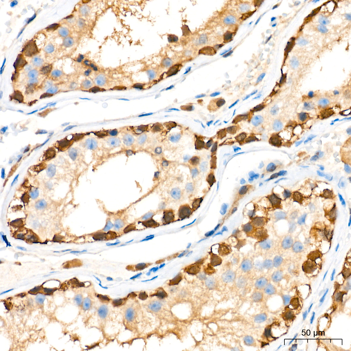PGP9.5/UCHL1 Rabbit Monoclonal Antibody - Image 19