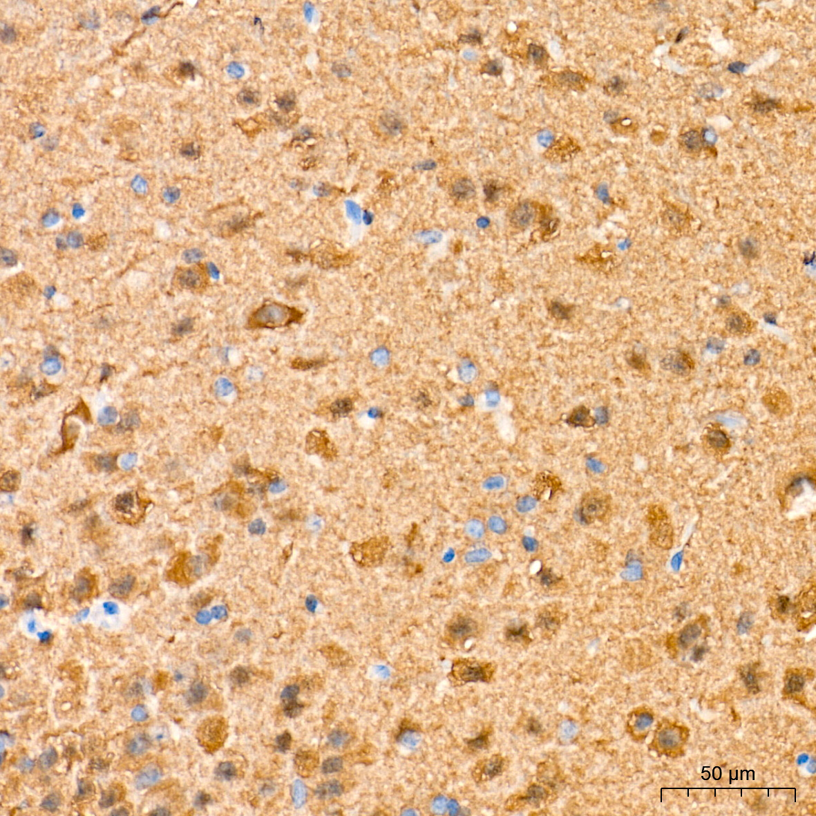PGP9.5/UCHL1 Rabbit Monoclonal Antibody - Image 20