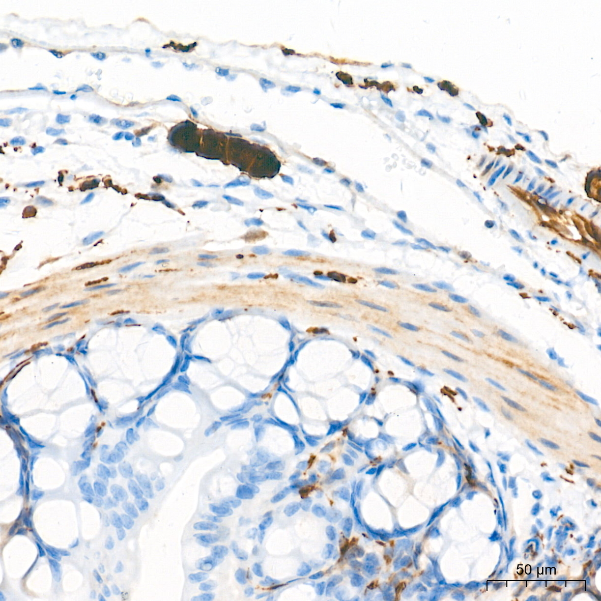 PGP9.5/UCHL1 Rabbit Monoclonal Antibody - Image 21