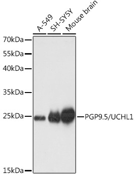 PGP9.5/UCHL1 Rabbit Polyclonal Antibody