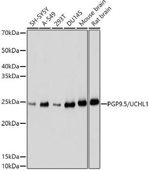 PGP9.5/UCHL1 Rabbit Polyclonal Antibody