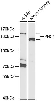 PHC1 Rabbit Polyclonal Antibody