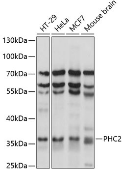 PHC2 Rabbit Polyclonal Antibody