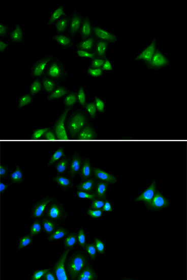 PHC3 Rabbit Polyclonal Antibody