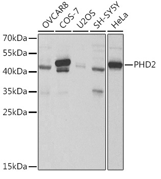 PHD2/EGLN1 Rabbit Polyclonal Antibody
