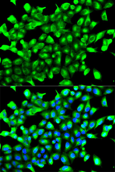 PHD2/EGLN1 Rabbit Polyclonal Antibody