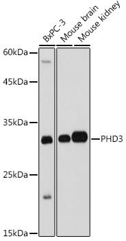 PHD3 Rabbit Polyclonal Antibody