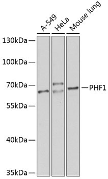 PHF1 Rabbit Polyclonal Antibody