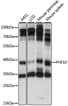 PHF10 Rabbit Polyclonal Antibody