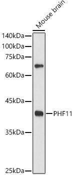 PHF11 Rabbit Polyclonal Antibody