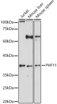 PHF11 Rabbit Polyclonal Antibody - Image 2
