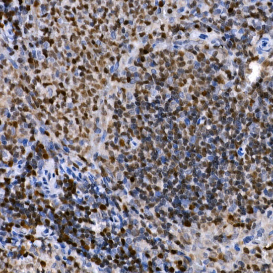 PHF11 Rabbit Polyclonal Antibody - Image 3