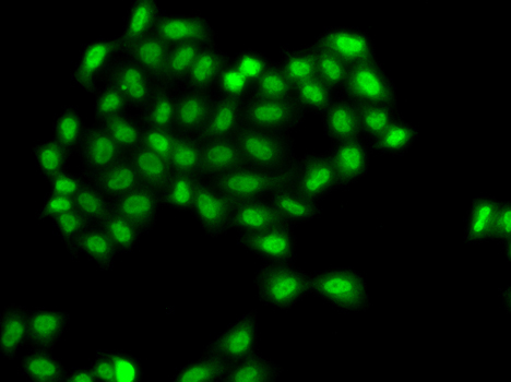 PHF11 Rabbit Polyclonal Antibody - Image 4