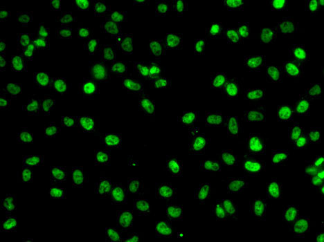 PHF19 Rabbit Polyclonal Antibody - Image 2
