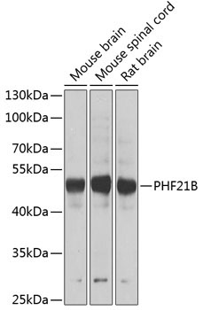 PHF21B Rabbit Polyclonal Antibody
