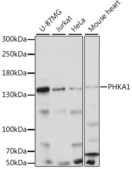 PHKA1 Rabbit Polyclonal Antibody