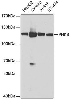 PHKB Rabbit Polyclonal Antibody