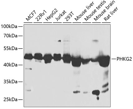 PHKG2 Rabbit Polyclonal Antibody