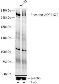 Phospho-ACC1-S79 Rabbit Polyclonal Antibody