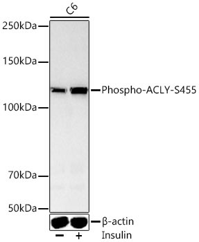 Phospho-ACLY-S455 Rabbit Polyclonal Antibody