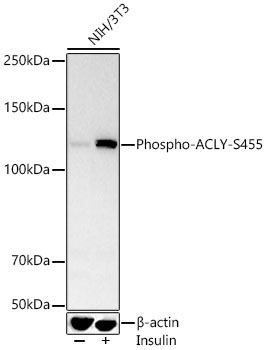Phospho-ACLY-S455 Rabbit Polyclonal Antibody - Image 2
