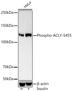 Phospho-ACLY-S455 Rabbit Polyclonal Antibody - Image 3