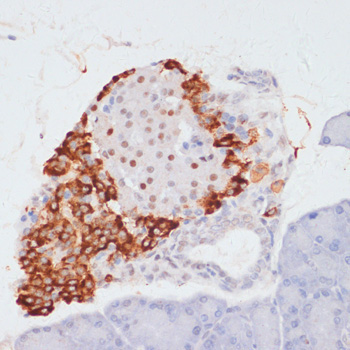 Phospho-ACLY-S455 Rabbit Polyclonal Antibody - Image 4
