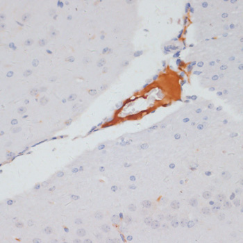 Phospho-ACLY-S455 Rabbit Polyclonal Antibody - Image 5