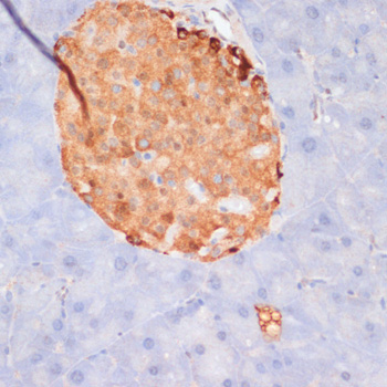 Phospho-ACLY-S455 Rabbit Polyclonal Antibody - Image 6