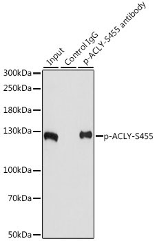 Phospho-ACLY-S455 Rabbit Polyclonal Antibody - Image 7