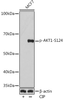 Phospho-AKT1-S124 Rabbit Monoclonal Antibody