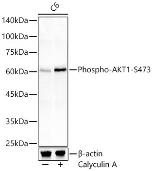Phospho-AKT1-S473 Rabbit Polyclonal Antibody