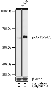 Phospho-AKT1-S473 Rabbit Polyclonal Antibody