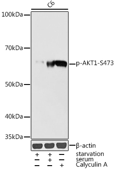 Phospho-AKT1-S473 Rabbit Polyclonal Antibody - Image 2