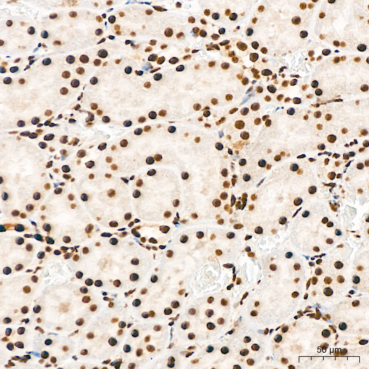 Phospho-AKT1-S473 Rabbit Polyclonal Antibody - Image 3