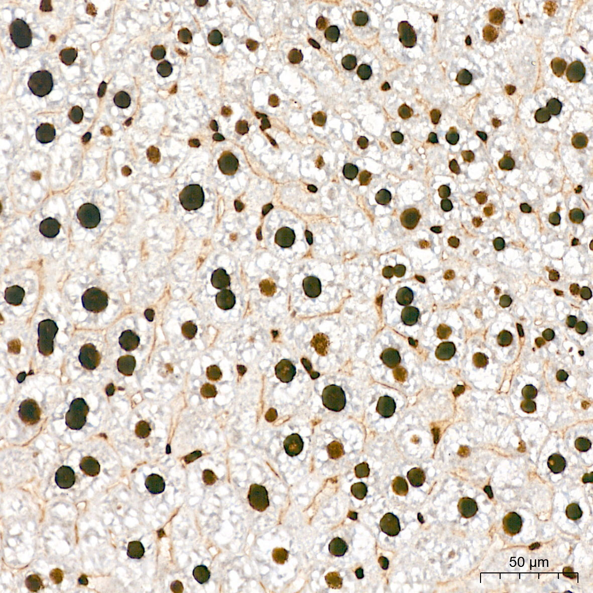 Phospho-AKT1-S473 Rabbit Polyclonal Antibody - Image 4