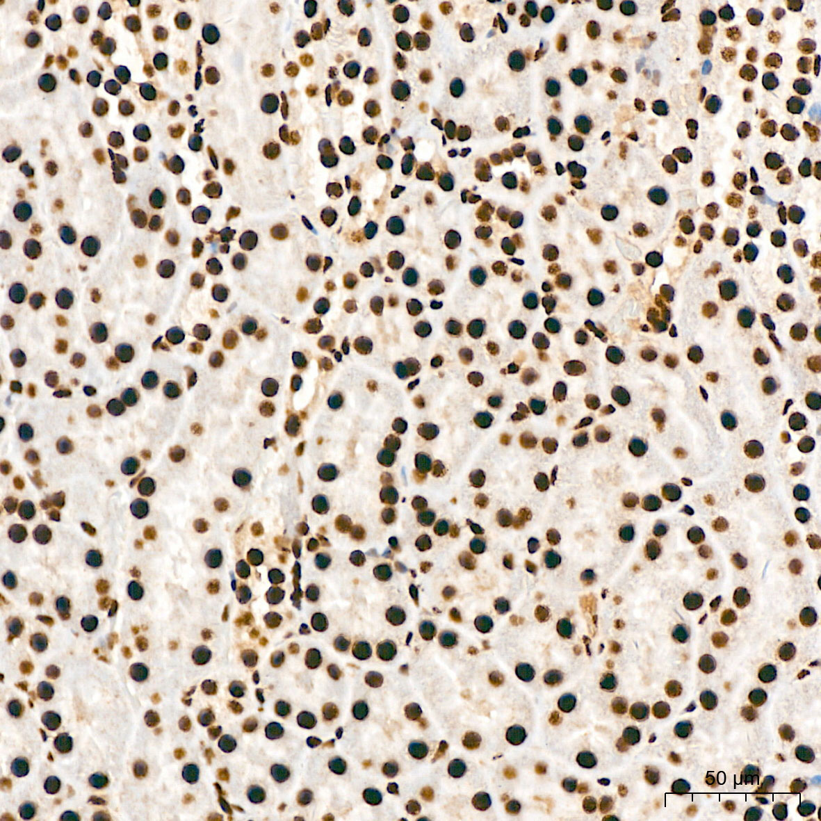 Phospho-AKT1-S473 Rabbit Polyclonal Antibody - Image 5