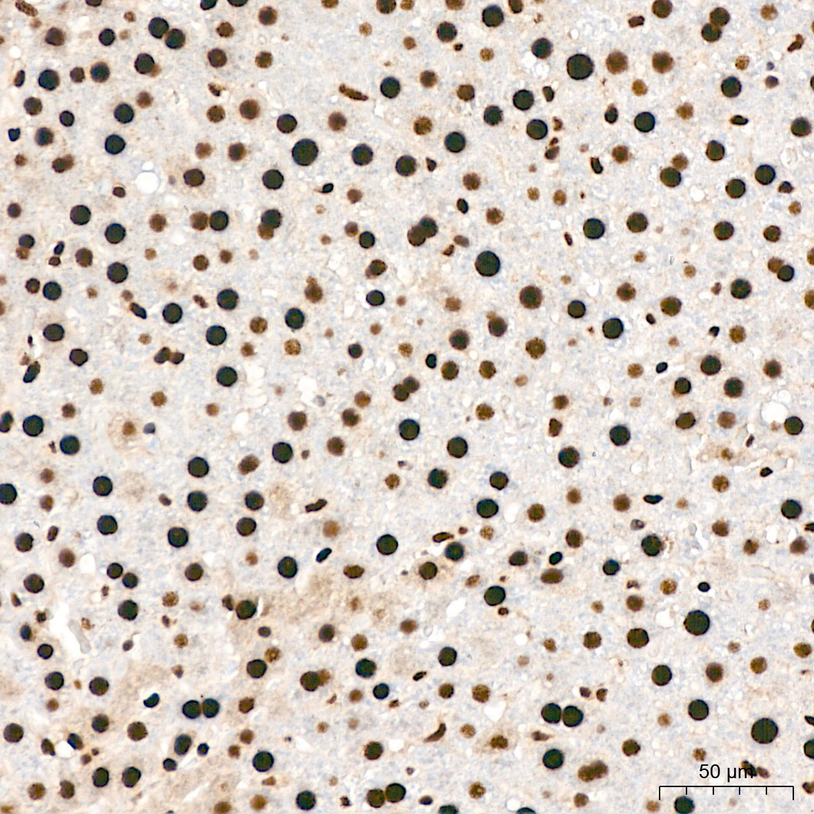 Phospho-AKT1-S473 Rabbit Polyclonal Antibody - Image 6
